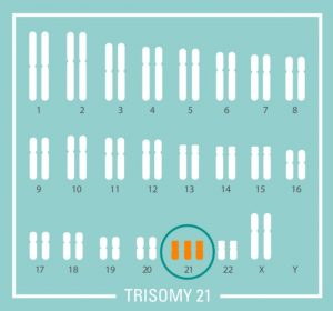 nipt nifty test fetal dna