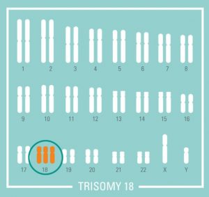 nipt nifty test fetal dna