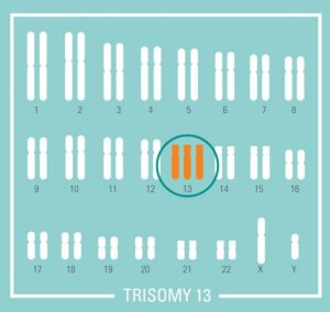 nipt nifty test fetal dna